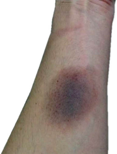 FX-330: Bruise Powder - Image 3